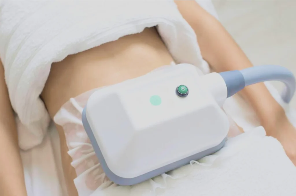 How Fat Freezing and HIFU Work Together? 3 advantages to combining Fat Freezing and HIFU Woking