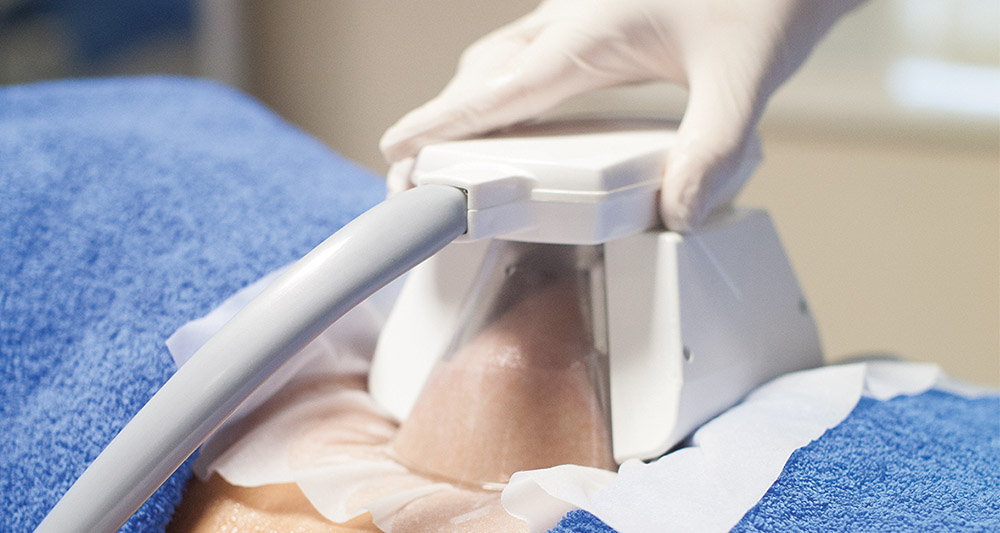 How Fat Freezing and HIFU Work Together? 2 Multiple Areas in One Session HIFU and Fat Freezing Woking