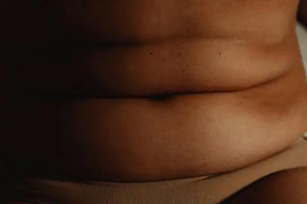 The Hidden Connection: How Stress Shapes Your Fitness and Body Composition 3 image of what stress can do on the stomach area and how Lipo 360 Woking can help to change your body shape.